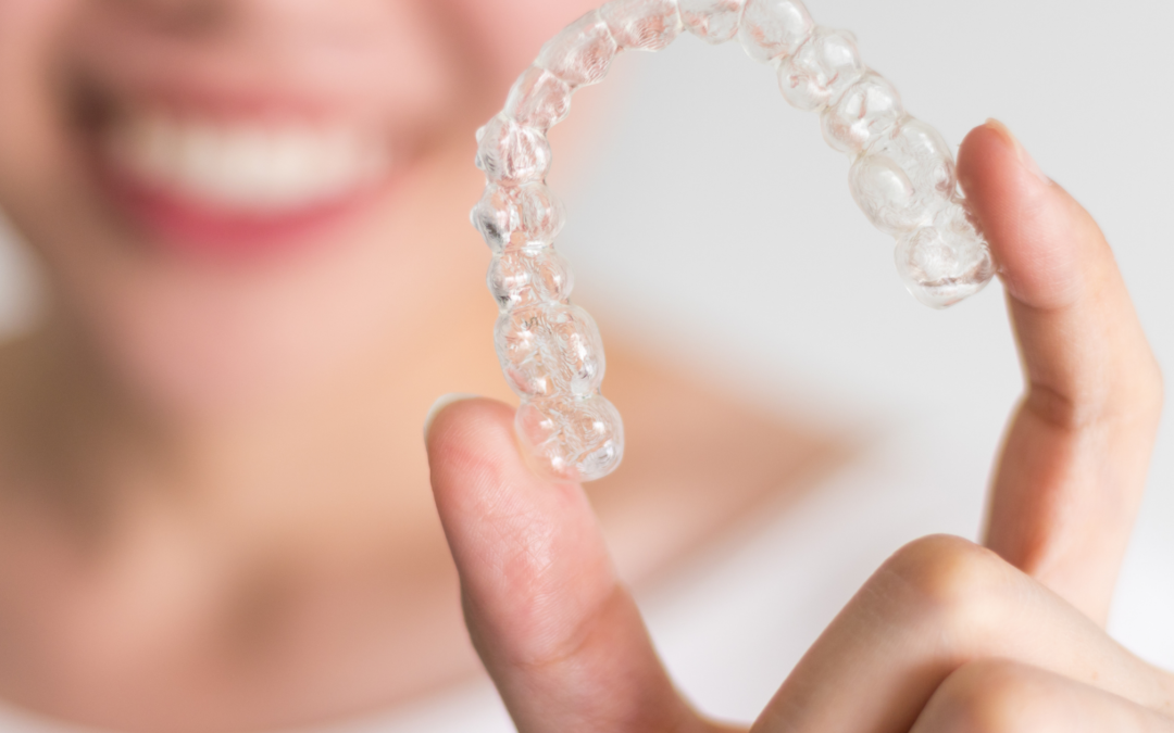 Some common questions about Invisalign™ & other clear aligner options